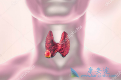 甲状腺癌症是头颈部最常见的恶性肿瘤