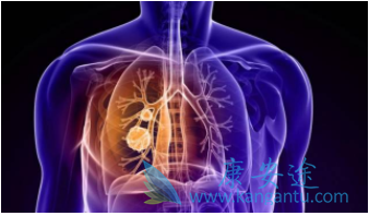 肺癌手术费用多少