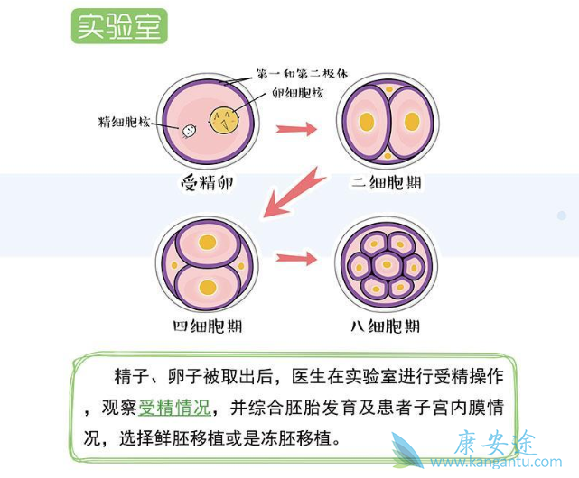 试管婴儿流程