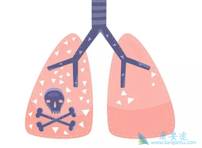 预防肺癌复发