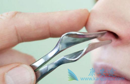鼻咽癌症状
