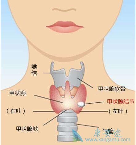 甲状腺癌症