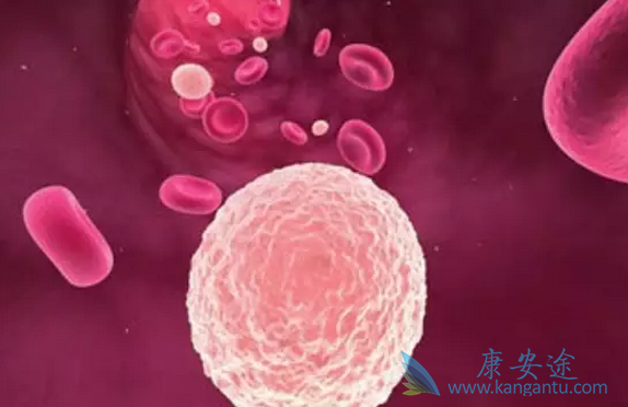 骨髓增生异常综合征
