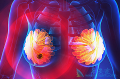 帕博西尼(palbociclib)联合治疗可使乳腺癌患者PFS增长一倍