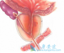 ǰٰ߷ð(ABIRATERONE)гֵѪصķ