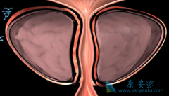 Ϊʲôǰٰ߸ƫӡȰ(ABIRATERONE)