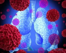 (ERLOTINIB)йΰߵļʸߴ81%