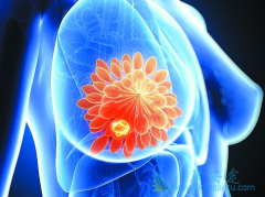 ٰں͡(Herceptin)ڼ䲻ƵLVEF