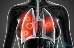 (ERLOTINIB)ڼЩӦԺ