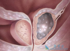 (Abiraterone)Чǰٰںϳۼصø