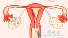 ķ(pembrolizumab)niraparibѳȵҩԸ