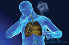 ۰ͷۻ߾ܴ䵥(nivolumab)/ŷл