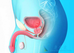 ³(enzalutamide)ǰٰЩ