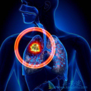 תƻʹò(Brigatinib)õORR