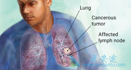 ��Сϸ���ΰ�