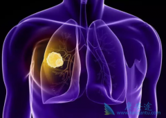 ƥ(ipilimumab)ɼܸƷ۰ߵ