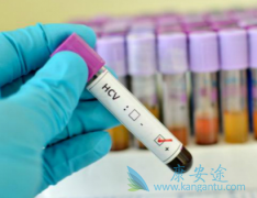 出现丙型肝炎并发症肝硬化后丙肝抗病毒治疗还有用吗？