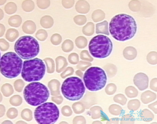 Щҩ(rituximab)CLL
