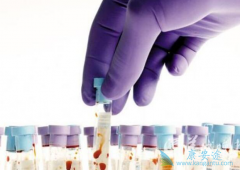 哪些人是丙肝病毒的易感高危人群？