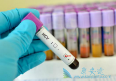 轻重度慢性丙肝症状有哪些？日常生活该如何预防丙肝传染？