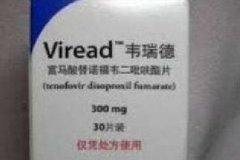 乙型肝炎的治疗方法 乙肝最佳治疗方案